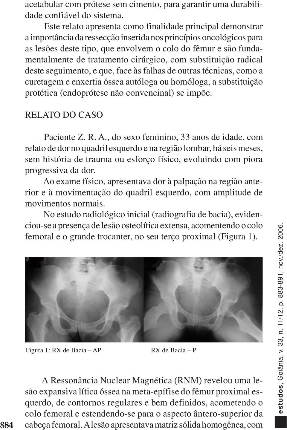 fundamentalmente de tratamento cirúrgico, com substituição radical deste seguimento, e que, face às falhas de outras técnicas, como a curetagem e enxertia óssea autóloga ou homóloga, a substituição