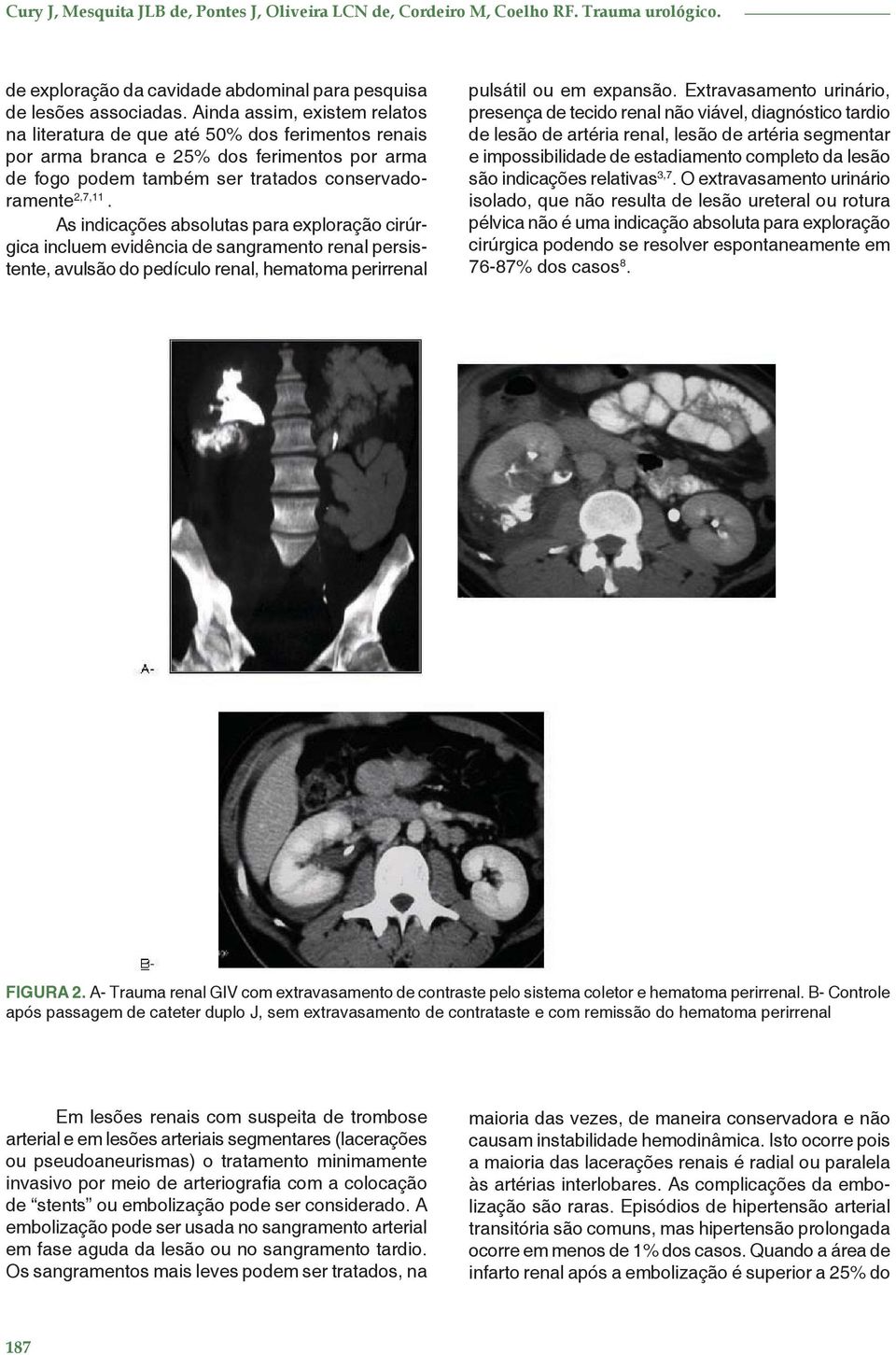 As indicações absolutas para exploração cirúrgica incluem evidência de sangramento renal persistente, avulsão do pedículo renal, hematoma perirrenal pulsátil ou em expansão.