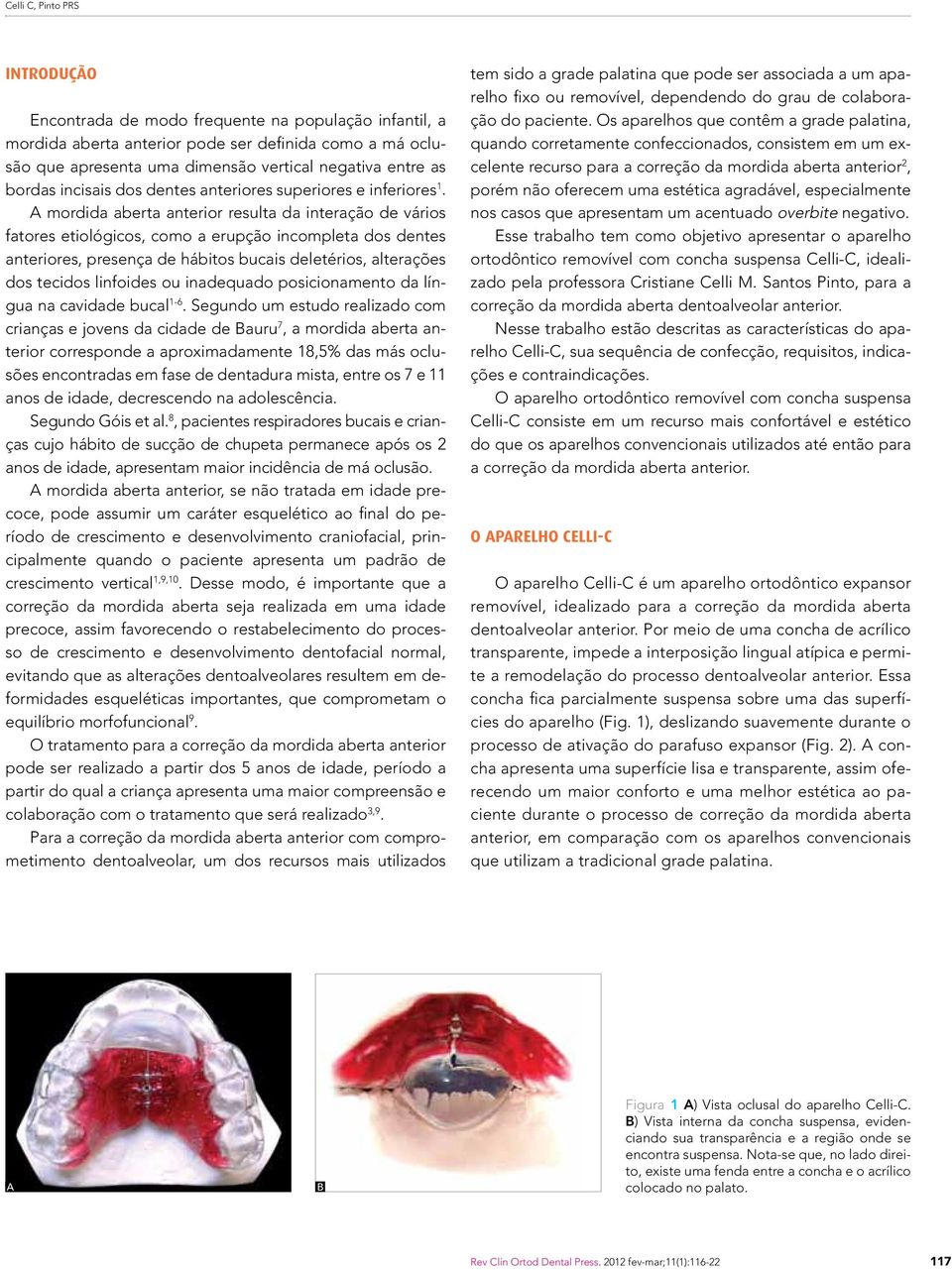 mordida aberta anterior resulta da interação de vários fatores etiológicos, como a erupção incompleta dos dentes anteriores, presença de hábitos bucais deletérios, alterações dos tecidos linfoides ou