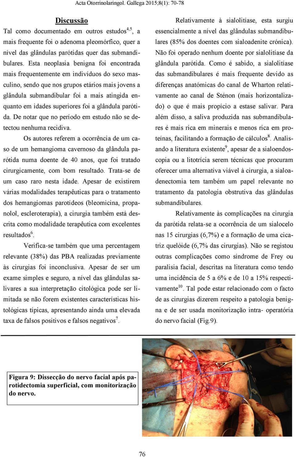 superiores foi a glândula parótida. De notar que no período em estudo não se detectou nenhuma recidiva.