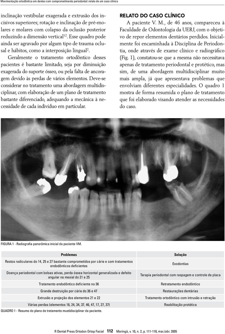 Geralmente o tratamento ortodôntico desses pacientes é bastante limitado, seja por diminuição exagerada do suporte ósseo, ou pela falta de ancoragem devido às perdas de vários elementos.