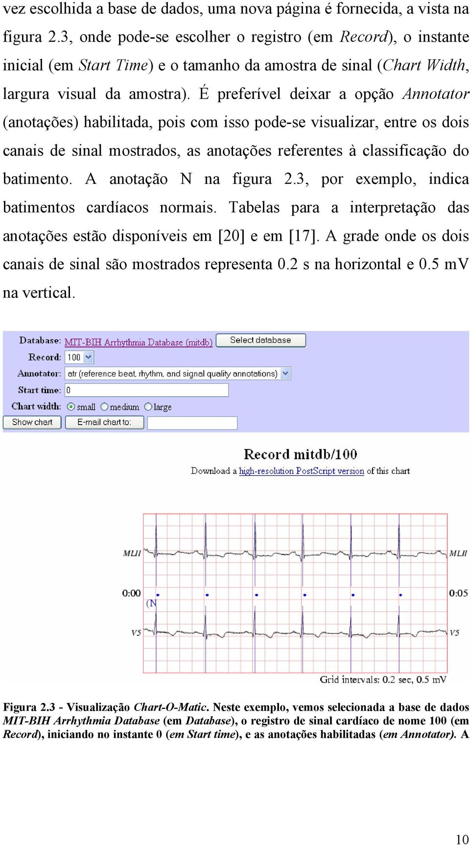 É preferível deixar a opção Annotator (anotações) habilitada, pois com isso pode-se visualizar, entre os dois canais de sinal mostrados, as anotações referentes à classificação do batimento.