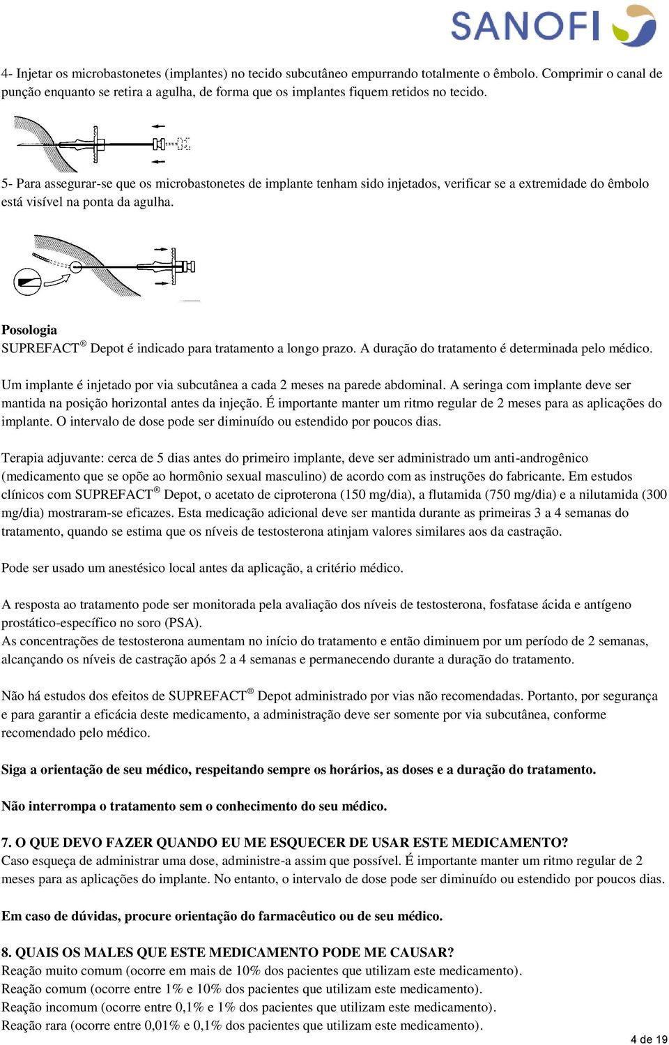 5- Para assegurar-se que os microbastonetes de implante tenham sido injetados, verificar se a extremidade do êmbolo está visível na ponta da agulha.