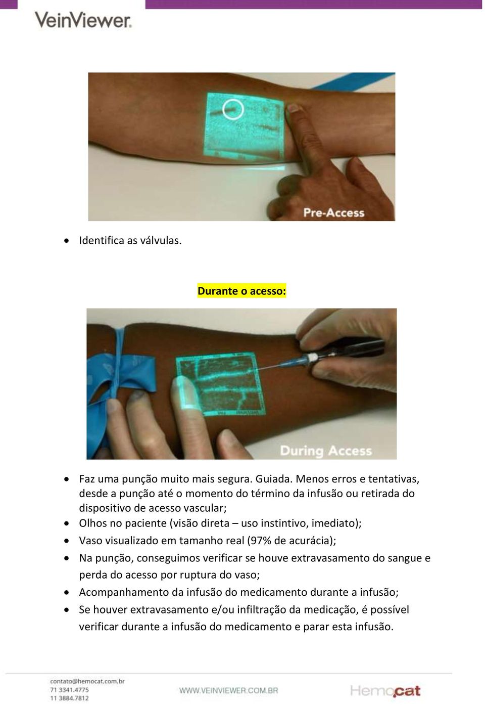 direta uso instintivo, imediato); Vaso visualizado em tamanho real (97% de acurácia); Na punção, conseguimos verificar se houve extravasamento do sangue