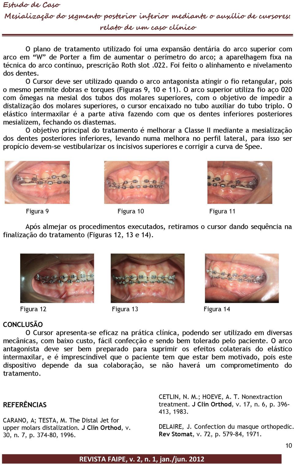 O Cursor deve ser utilizado quando o arco antagonista atingir o fio retangular, pois o mesmo permite dobras e torques (Figuras 9, 10 e 11).