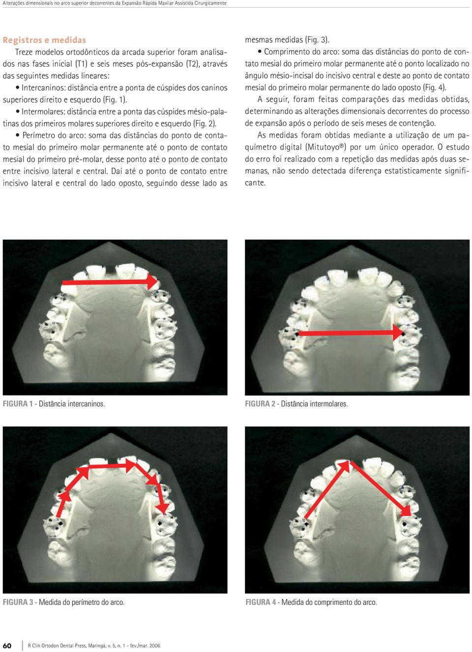 Intermolares: distância entre a ponta das cúspides mésio-palatinas dos primeiros molares superiores direito e esquerdo (Fig. 2).