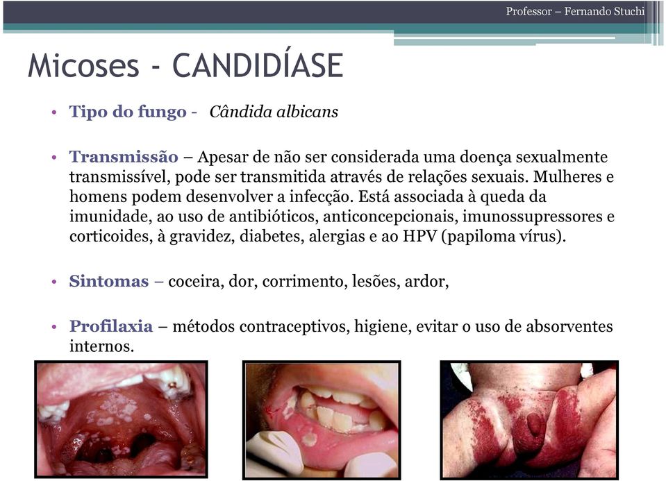 Está associada à queda da imunidade, ao uso de antibióticos, anticoncepcionais, imunossupressores e corticoides, à gravidez,