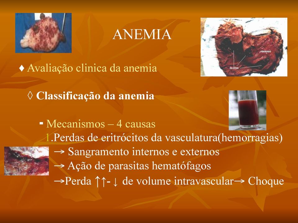 vasculatura(hemorragias) Sangramento internos e