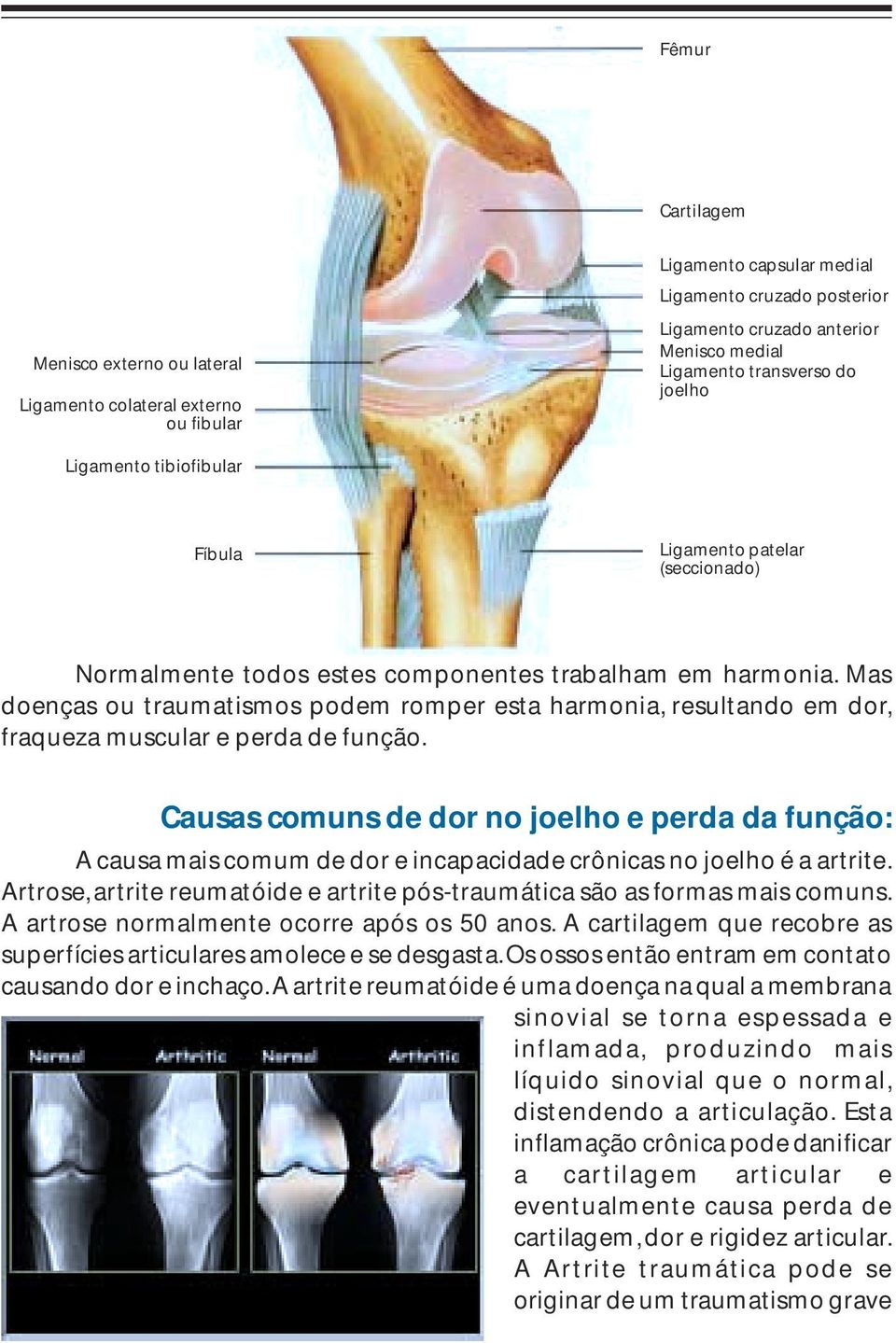 Mas doenças ou traumatismos podem romper esta harmonia, resultando em dor, fraqueza muscular e perda de função.