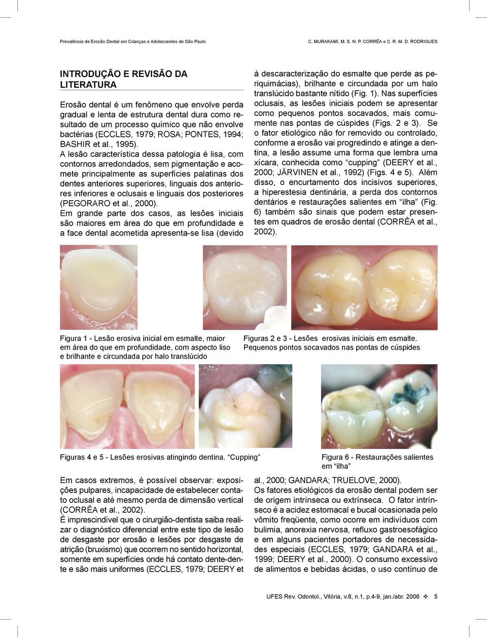 A lesão característica dessa patologia é lisa, com contornos arredondados, sem pigmentação e acomete principalmente as superfícies palatinas dos dentes anteriores superiores, linguais dos anteriores