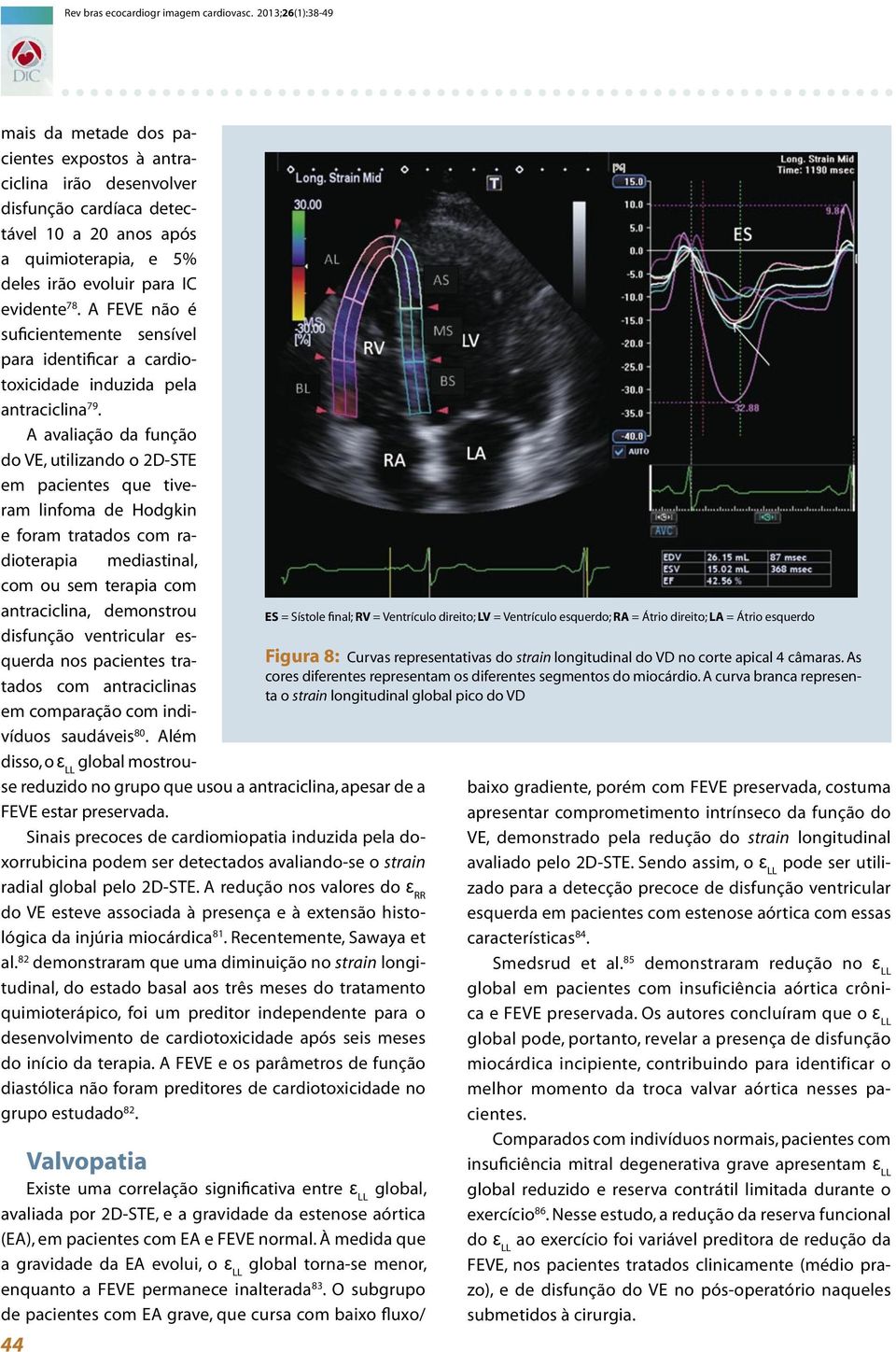 A FEVE não é suficientemente sensível para identificar a cardiotoxicidade induzida pela antraciclina 79.