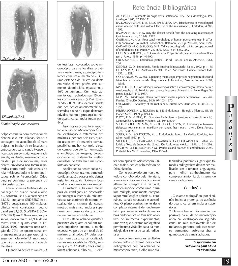 Houve dificuldade em constatar essa entrada em alguns dentes, mesmo com ajuda da lupa e de sonda-lima; esses dentes duvidosos não foram registrados como tendo dois canais na raiz mésiovestibular e