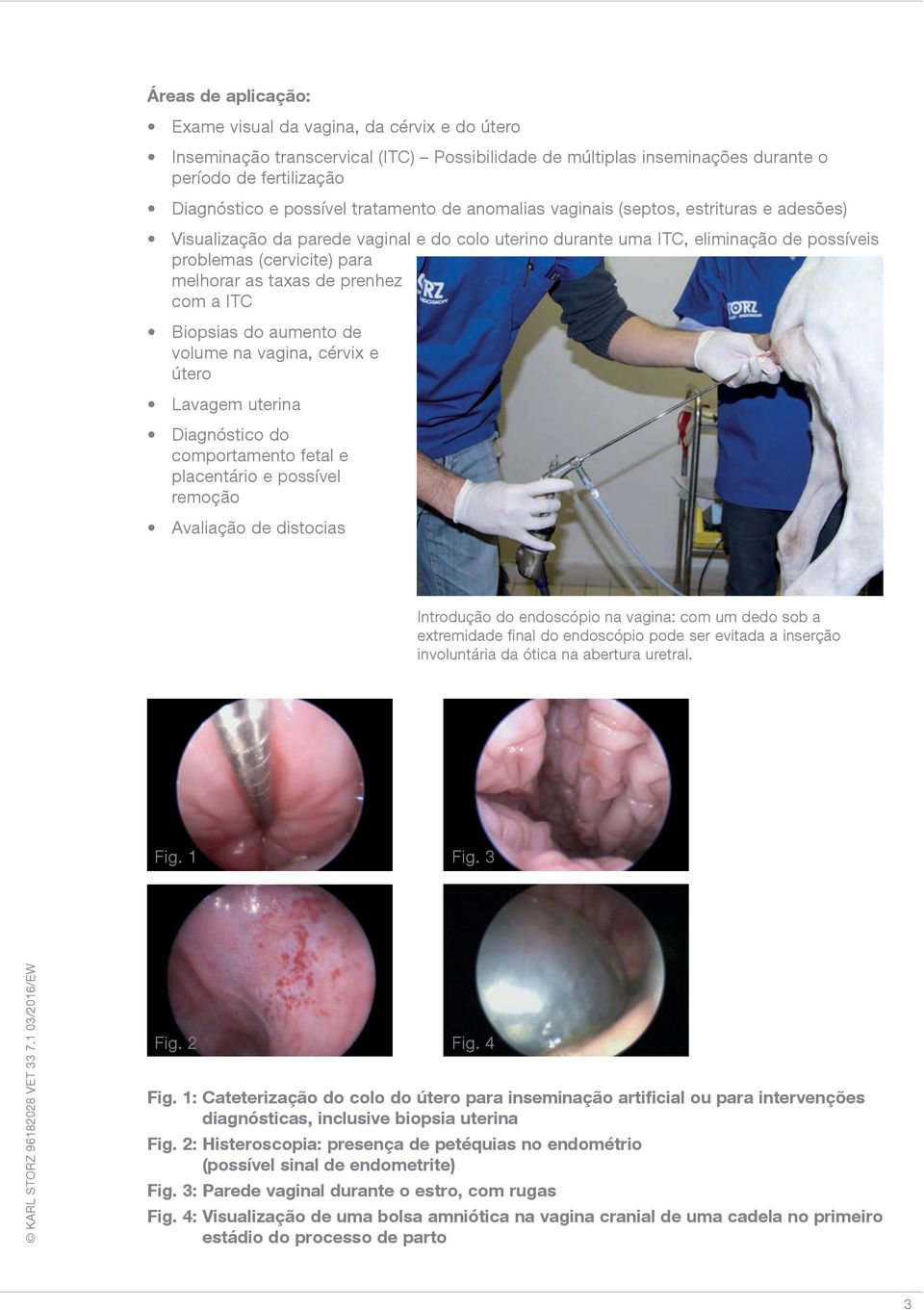 de prenhez com a ITC Biopsias do aumento de volume na vagina, cérvix e útero Lavagem uterina Diagnóstico do comportamento fetal e placentário e possível remoção Avaliação de distocias Introdução do