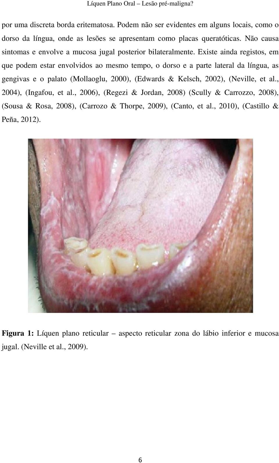 Existe ainda registos, em que podem estar envolvidos ao mesmo tempo, o dorso e a parte lateral da língua, as gengivas e o palato (Mollaoglu, 2000), (Edwards & Kelsch, 2002),