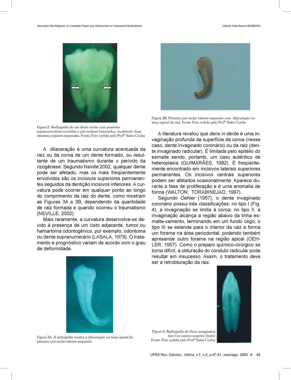 Segundo Neville 2002, qualquer dente pode ser afetado, mas os mais freqüentemente envolvidos são os incisivos superiores permanentes seguidos da dentição incisivos inferiores.