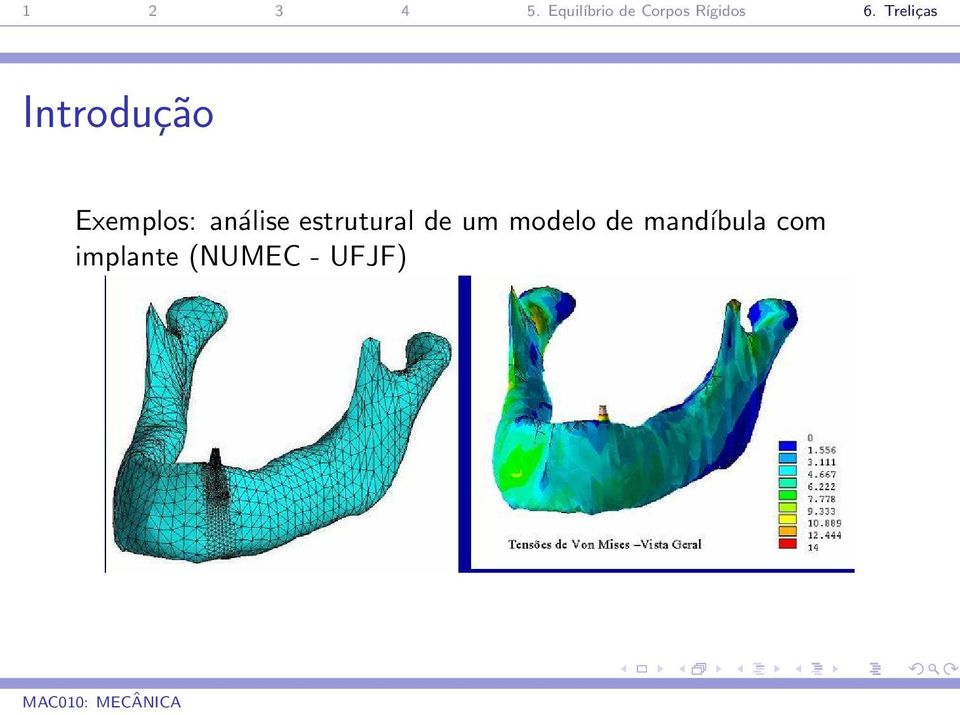 um modelo de mandíbula