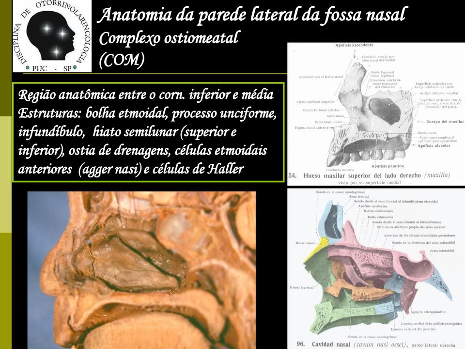 inferior e média Estruturas: bolha etmoidal, processo unciforme,