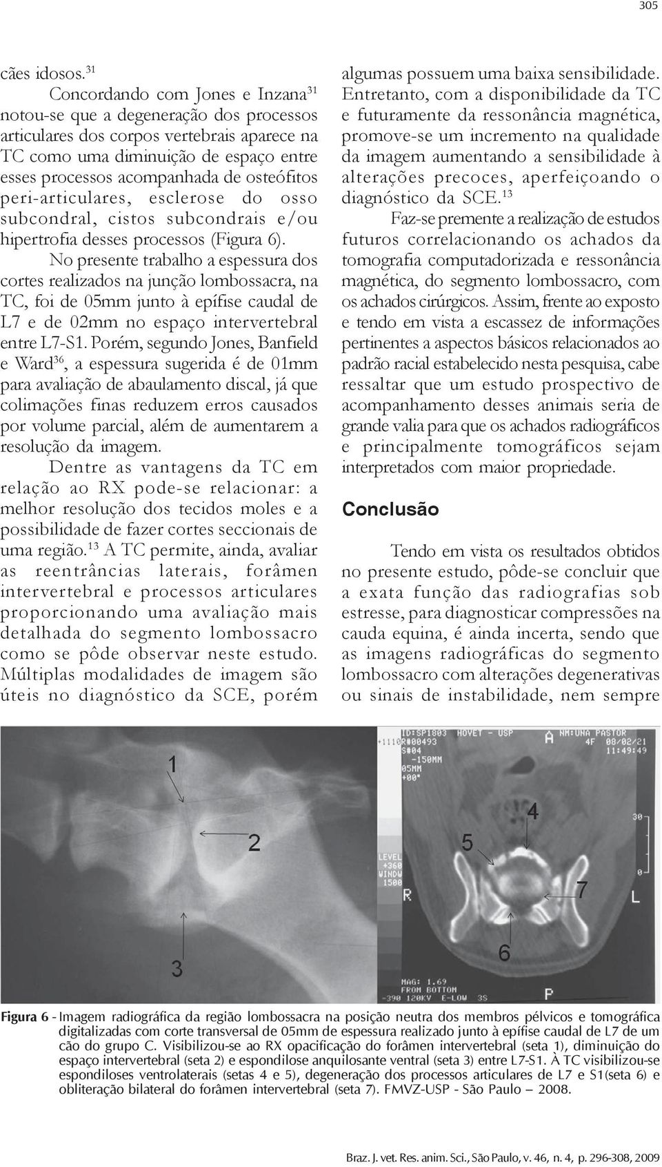 osteófitos peri-articulares, esclerose do osso subcondral, cistos subcondrais e/ou hipertrofia desses processos (Figura 6).