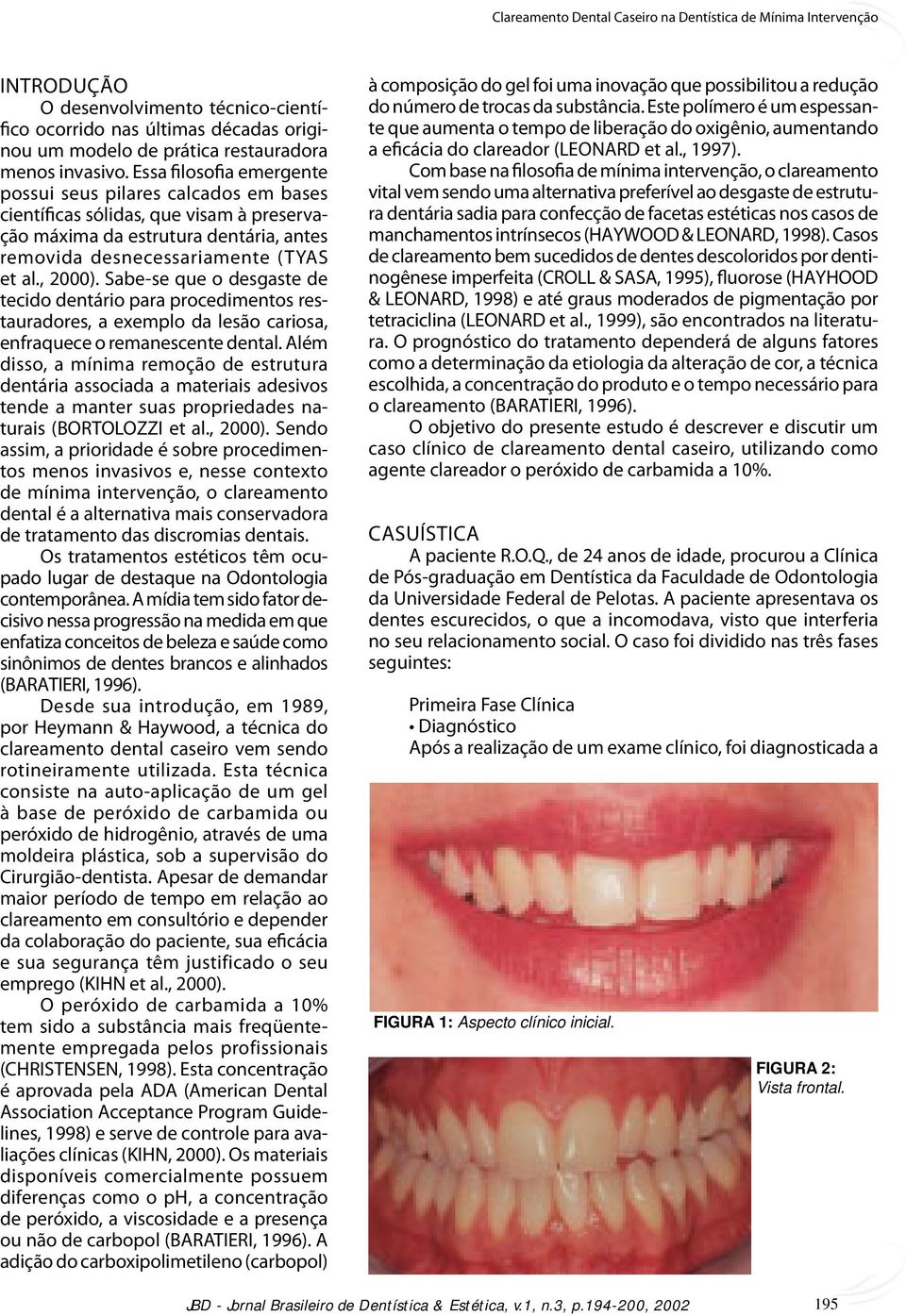 Sabe-se que o desgaste de tecido dentário para procedimentos restauradores, a exemplo da lesão cariosa, enfraquece o remanescente dental.