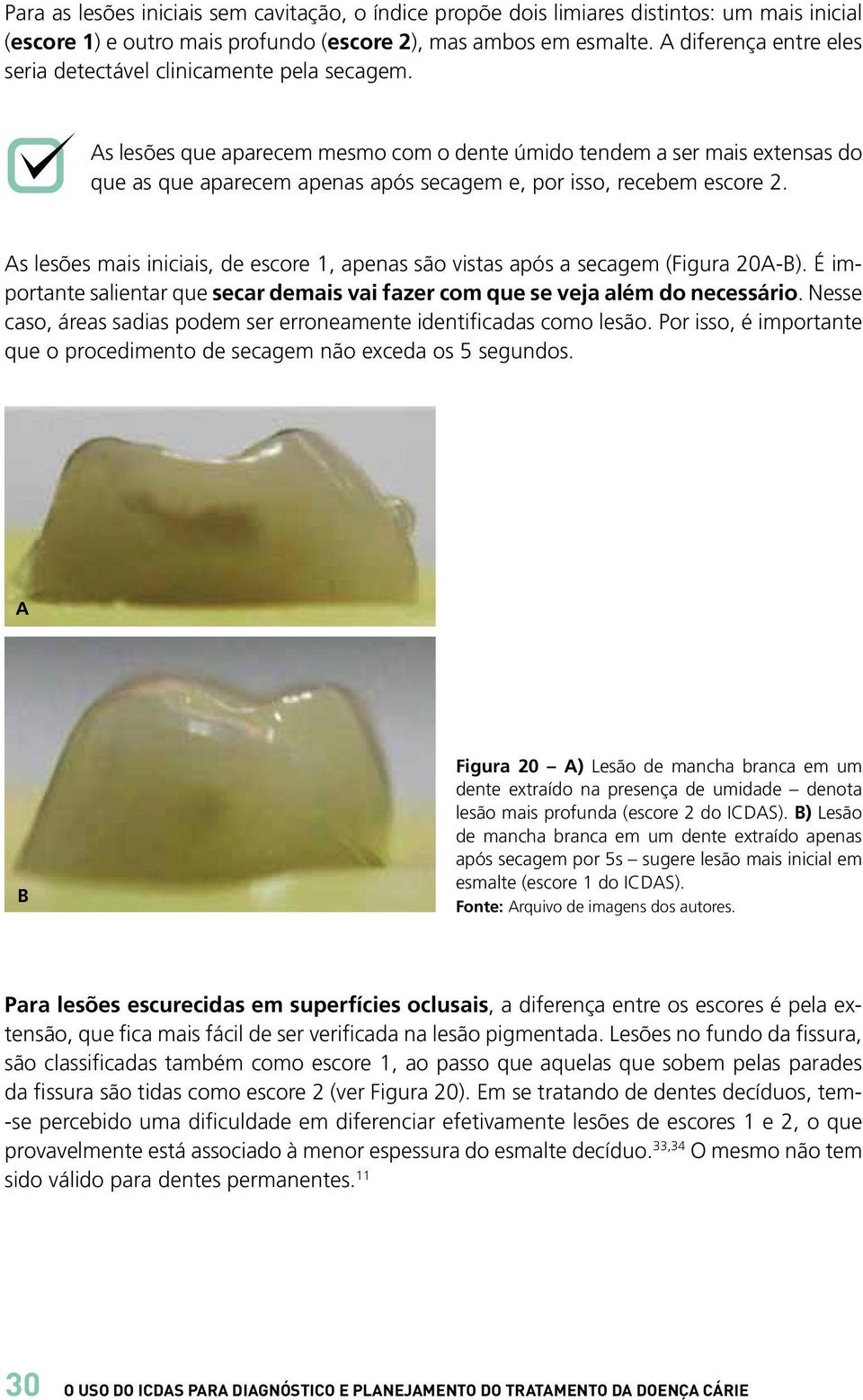 As lesões que aparecem mesmo com o dente úmido tendem a ser mais extensas do que as que aparecem apenas após secagem e, por isso, recebem escore 2.