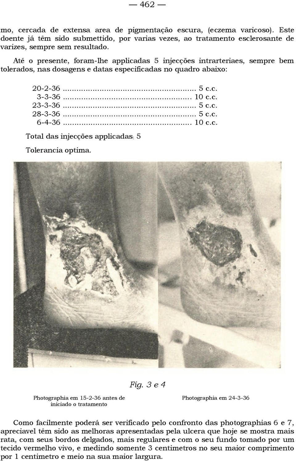 .. 5 c.c. 6-4-36... 10 c.c. Total das injecções applicadas: 5 Tolerancia optima. Fig.