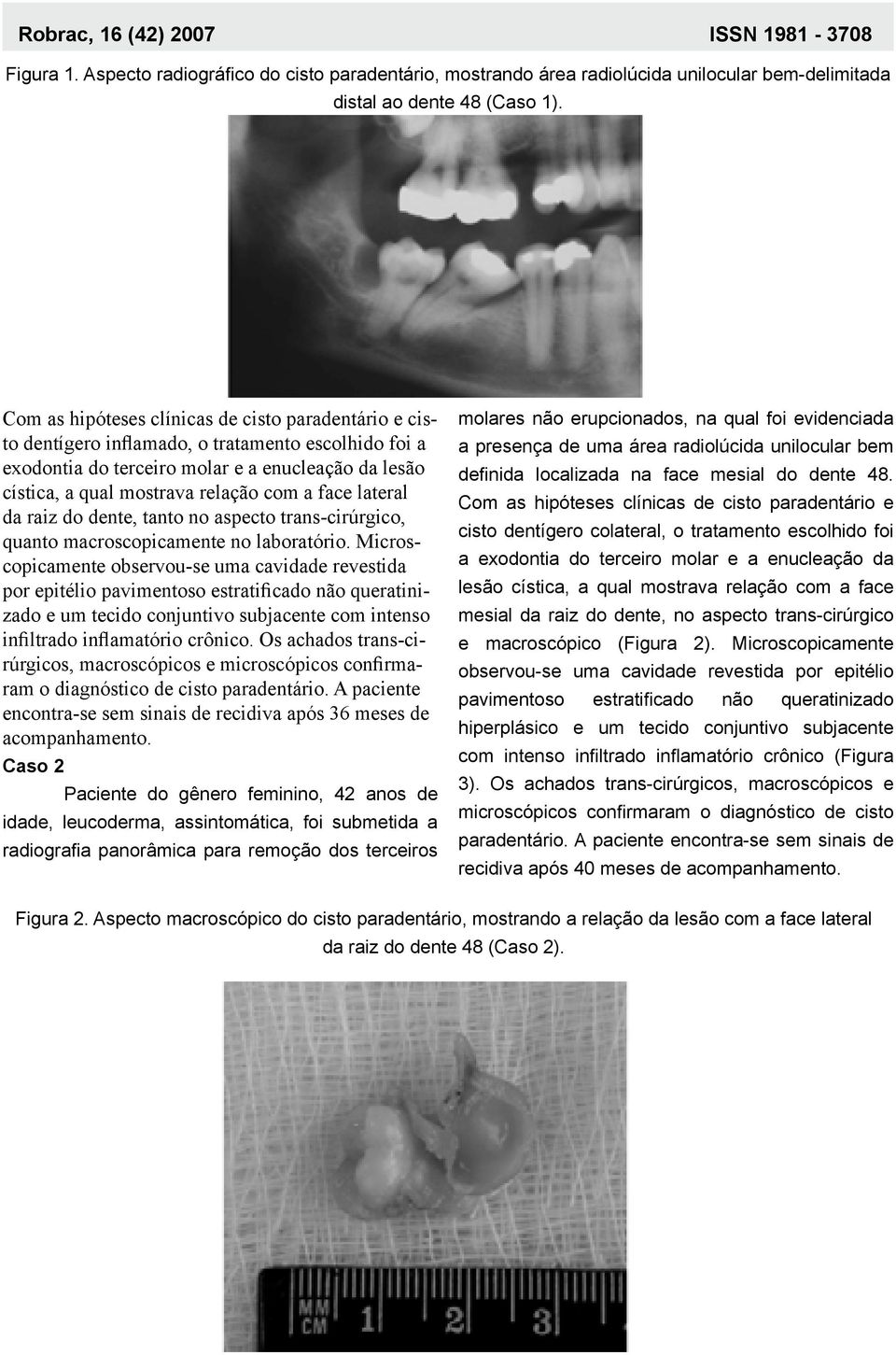 face lateral da raiz do dente, tanto no aspecto trans-cirúrgico, quanto macroscopicamente no laboratório.