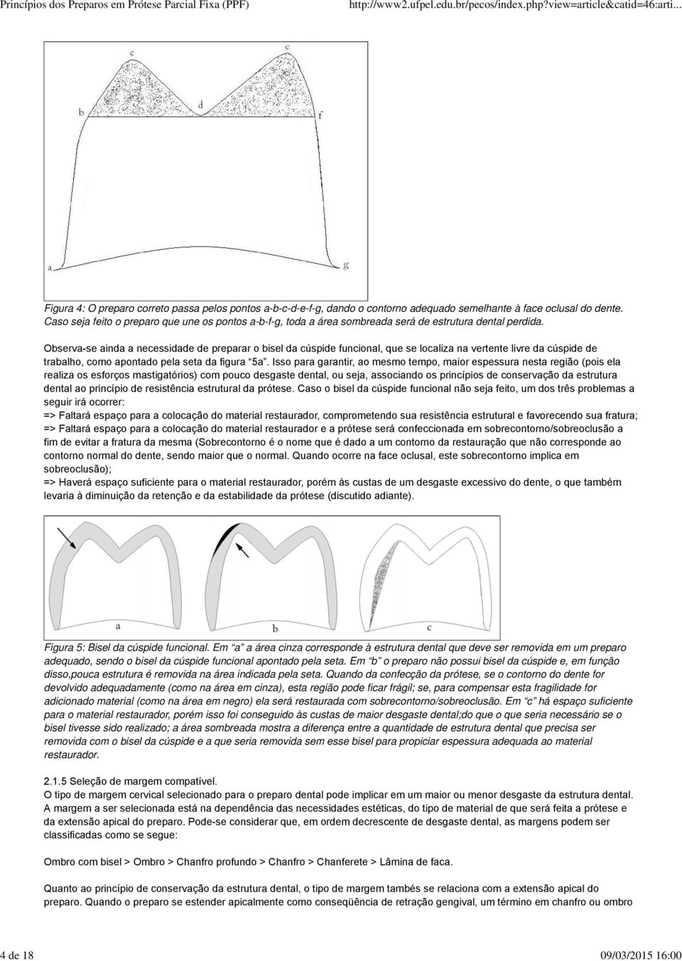 Observa-se ainda a necessidade de preparar o bisel da cúspide funcional, que se localiza na vertente livre da cúspide de trabalho, como apontado pela seta da figura 5a.