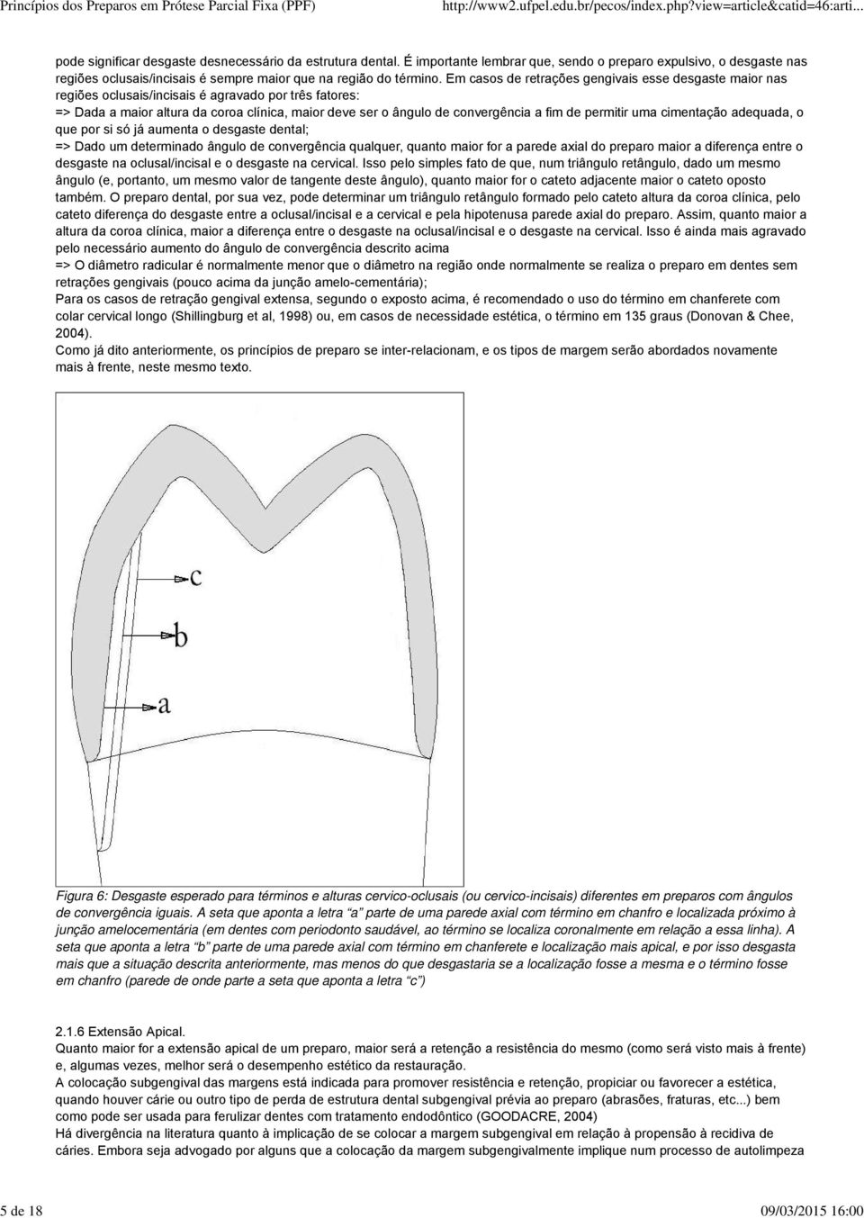 Em casos de retrações gengivais esse desgaste maior nas regiões oclusais/incisais é agravado por três fatores: => Dada a maior altura da coroa clínica, maior deve ser o ângulo de convergência a fim