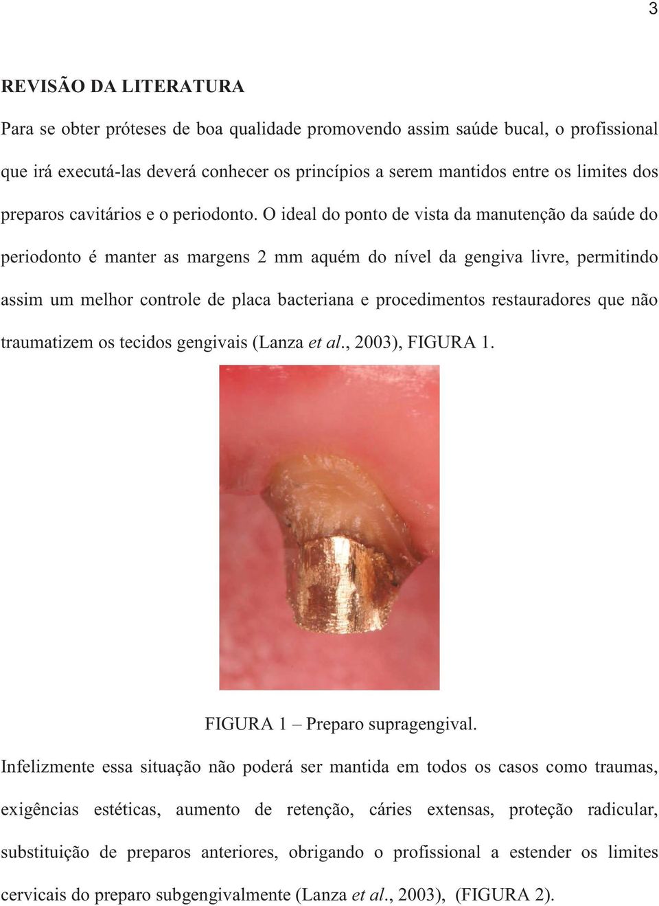 O ideal do ponto de vista da manutenção da saúde do periodonto é manter as margens 2 mm aquém do nível da gengiva livre, permitindo assim um melhor controle de placa bacteriana e procedimentos