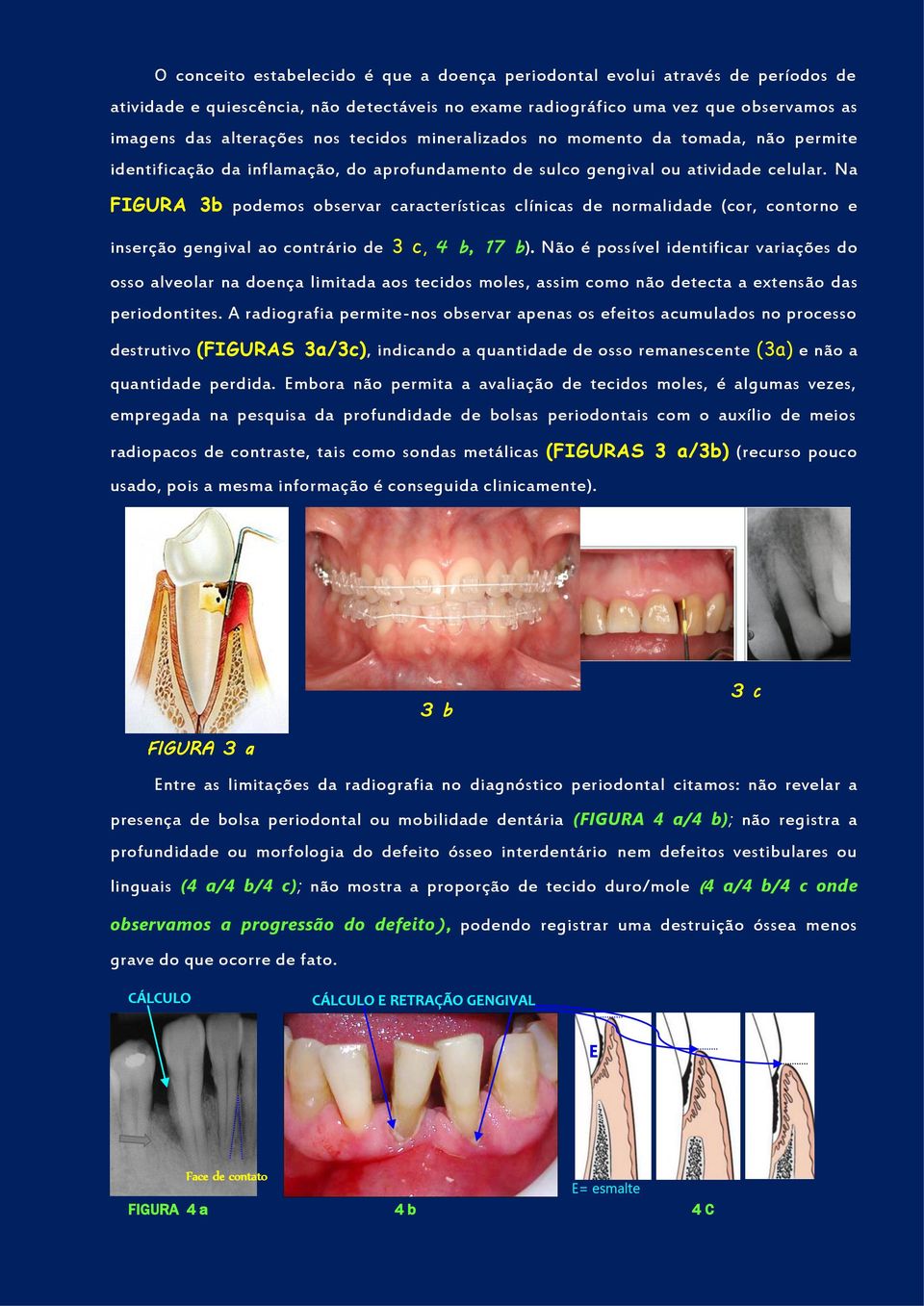Na FIGURA 3b podemos observar características clínicas de normalidade (cor, contorno e inserção gengival ao contrário de 3 c, 4 b, 17 b).
