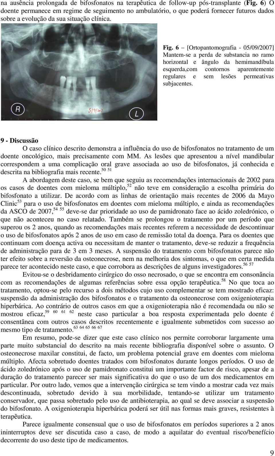 6 [Ortopantomografia - 05/09/2007] Mantem-se a perda de substancia no ramo horizontal e ângulo da hemimandíbula esquerda,com contornos aparentemente regulares e sem lesões permeativas subjacentes.