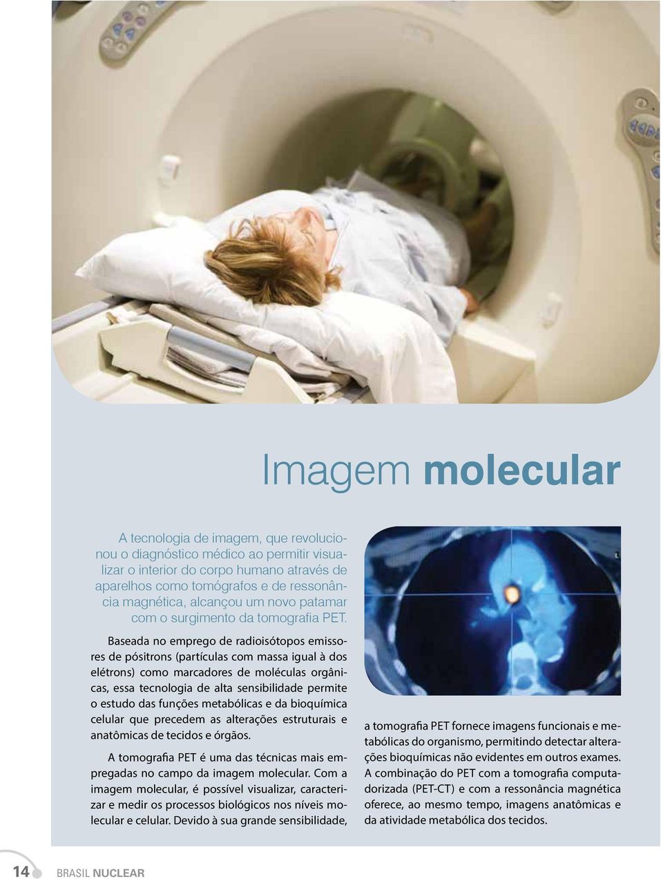 Baseada no emprego de radioisótopos emissores de pósitrons (partículas com massa igual à dos elétrons) como marcadores de moléculas orgânicas, essa tecnologia de alta sensibilidade permite o estudo