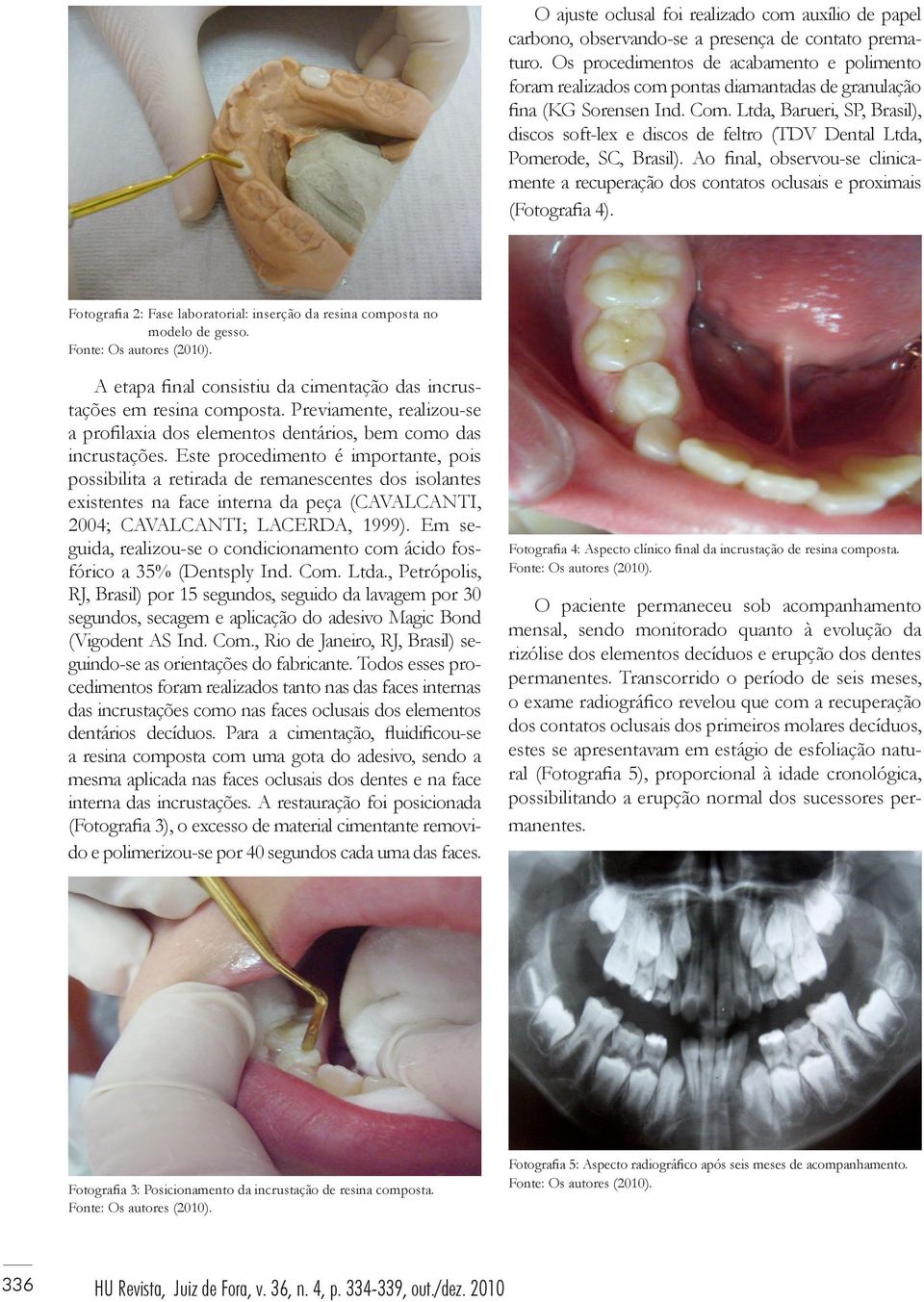 Ltda, Barueri, SP, Brasil), discos soft-lex e discos de feltro (TDV Dental Ltda, Pomerode, SC, Brasil).