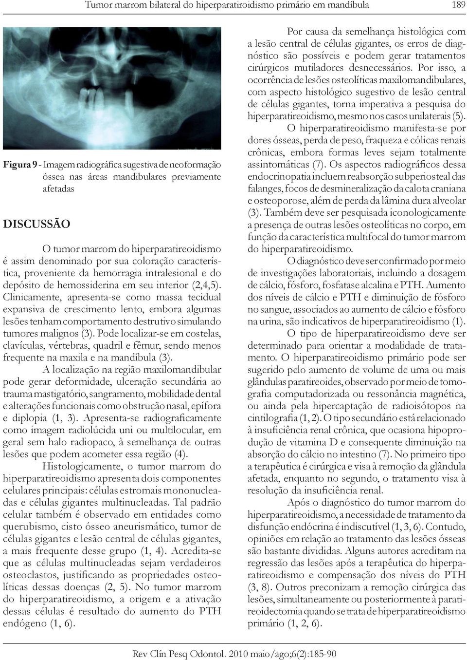 Clinicamente, apresenta-se como massa tecidual expansiva de crescimento lento, embora algumas lesões tenham comportamento destrutivo simulando tumores malignos (3).