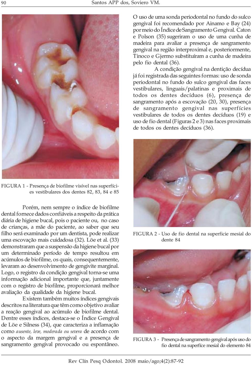 pelo fio dental (36).