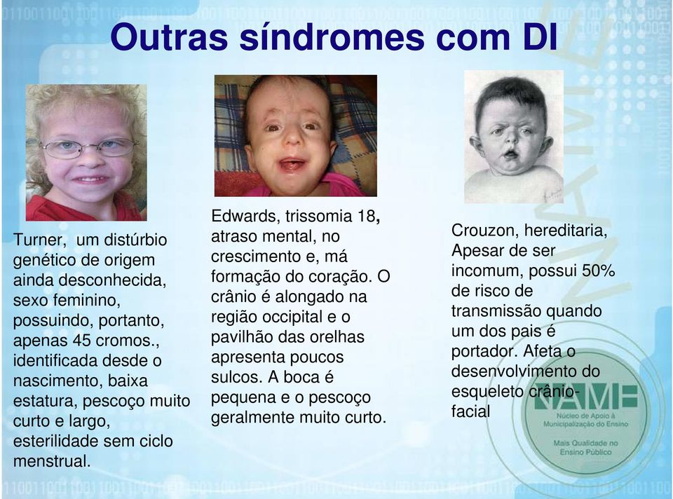 Edwards, trissomia 18, atraso mental, no crescimento e, má formação do coração.