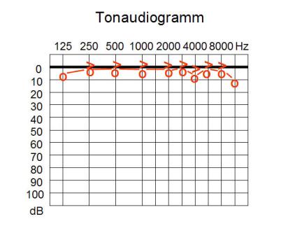 Gama de Frequências Ouvidas A sensibilidade do ouvido humano varia com a frequência (equal-loudness contour). Esta sensibilidade também pode variar ao longo da vida de um individuo.