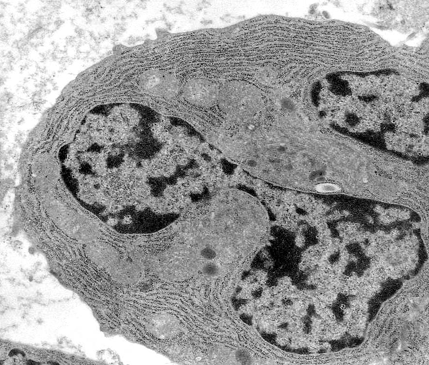 Plasmócitos Grande quantidade de retículo endoplasmático rugoso RER.