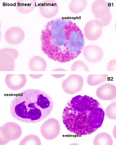 Neutrófilos e Eosinófilos Neutrófilos: correspondem a 95% dos fagócitos circulantes.