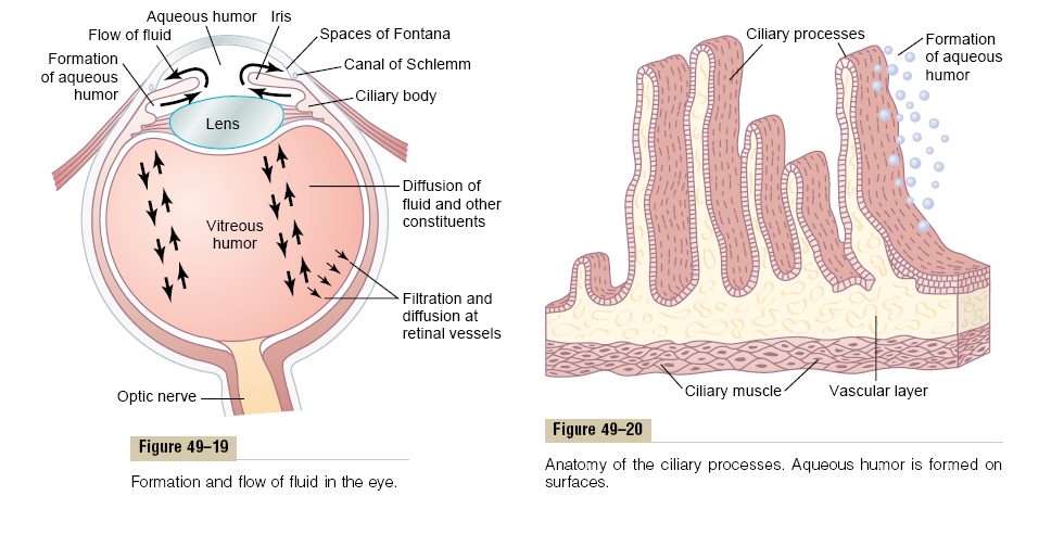 Glaucoma