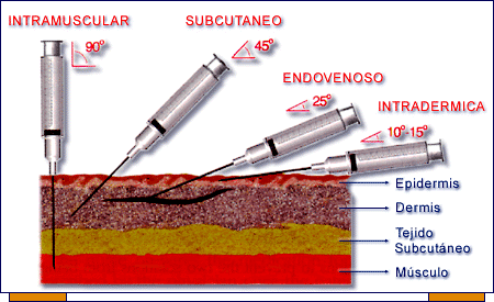 Esquema representando a diferença entre as via intramuscular, subcutânea, endovenosa