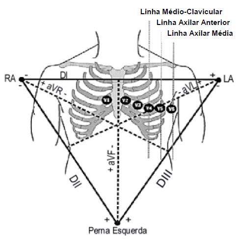 118 Figura A1.4: Triângulo de Einthoven [103].