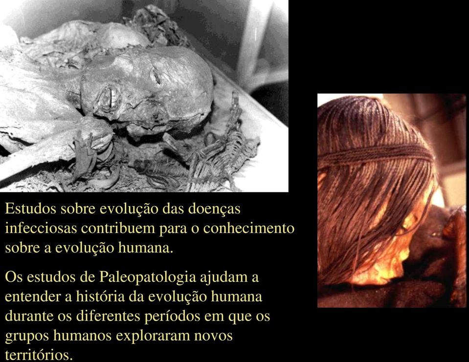 Os estudos de Paleopatologia ajudam a entender a história da