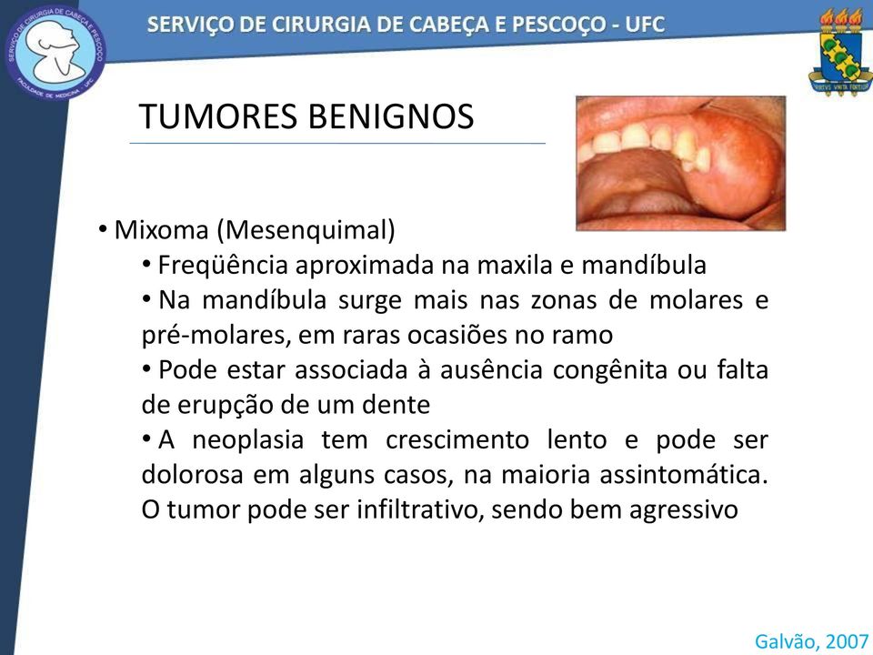 associada à ausência congênita ou falta de erupção de um dente A neoplasia tem crescimento lento e