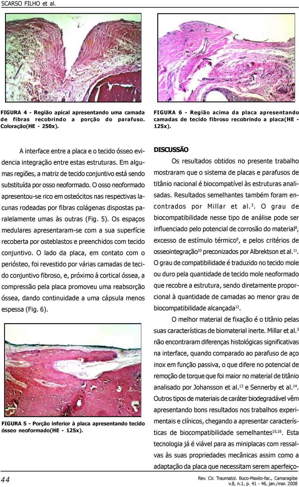 Em algumas regiões, a matriz de tecido conjuntivo está sendo substituída por osso neoformado.