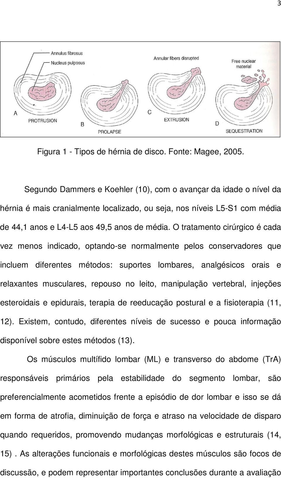 O tratamento cirúrgico é cada vez menos indicado, optando-se normalmente pelos conservadores que incluem diferentes métodos: suportes lombares, analgésicos orais e relaxantes musculares, repouso no