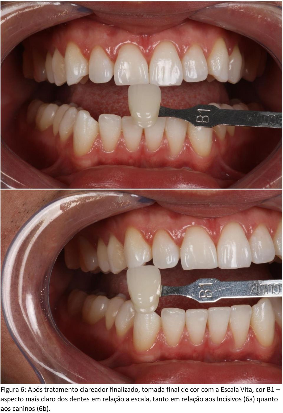 aspecto mais claro dos dentes em relação a escala,