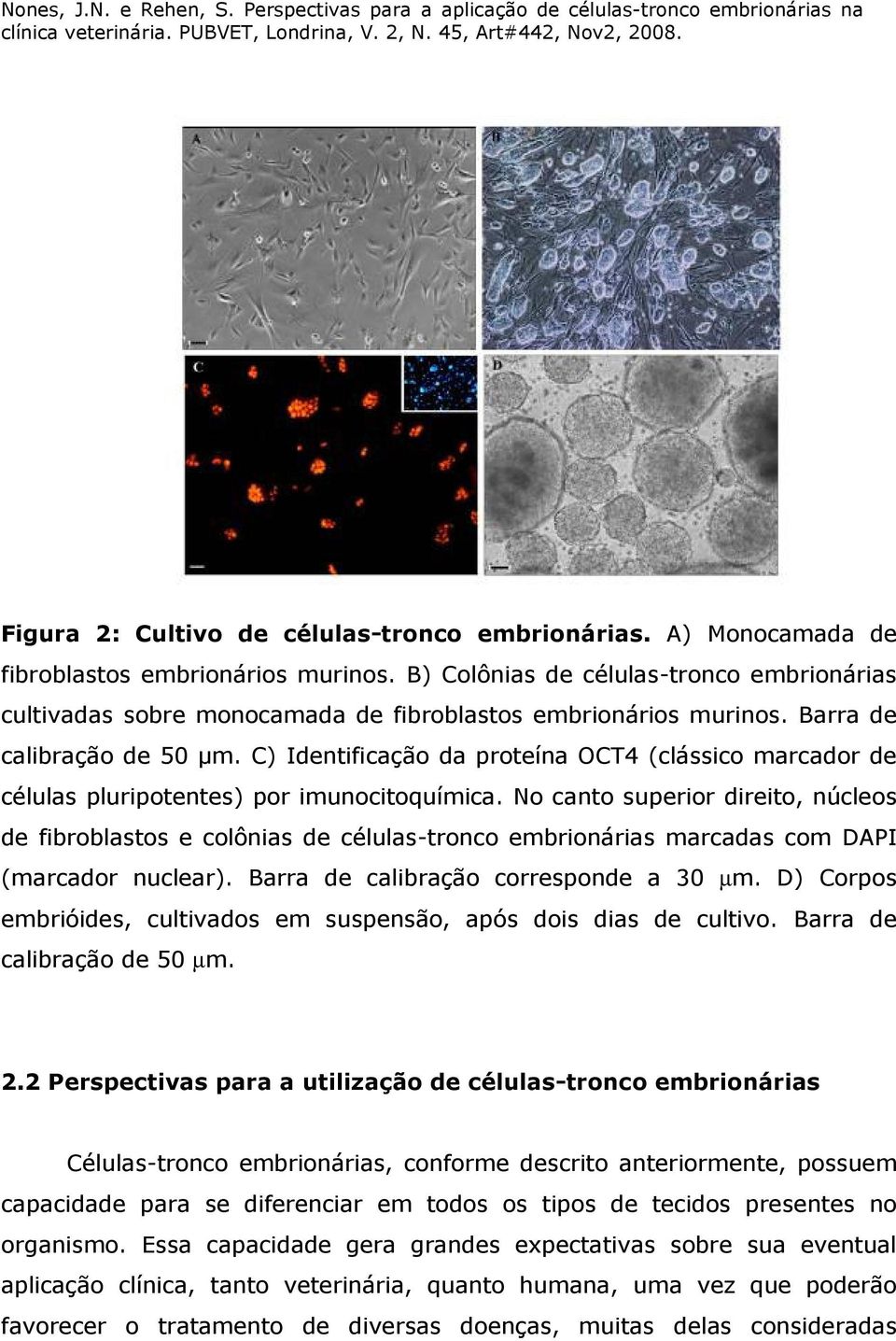 C) Identificação da proteína OCT4 (clássico marcador de células pluripotentes) por imunocitoquímica.