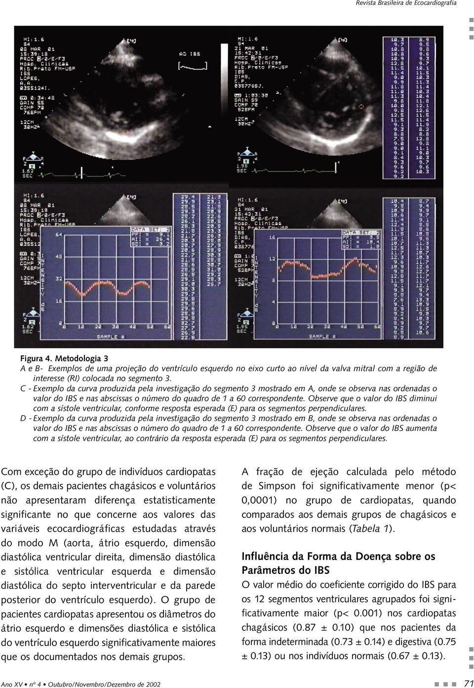 Observe que o valor do IBS diminui com a sístole ventricular, conforme resposta esperada (E) para os segmentos perpendiculares.