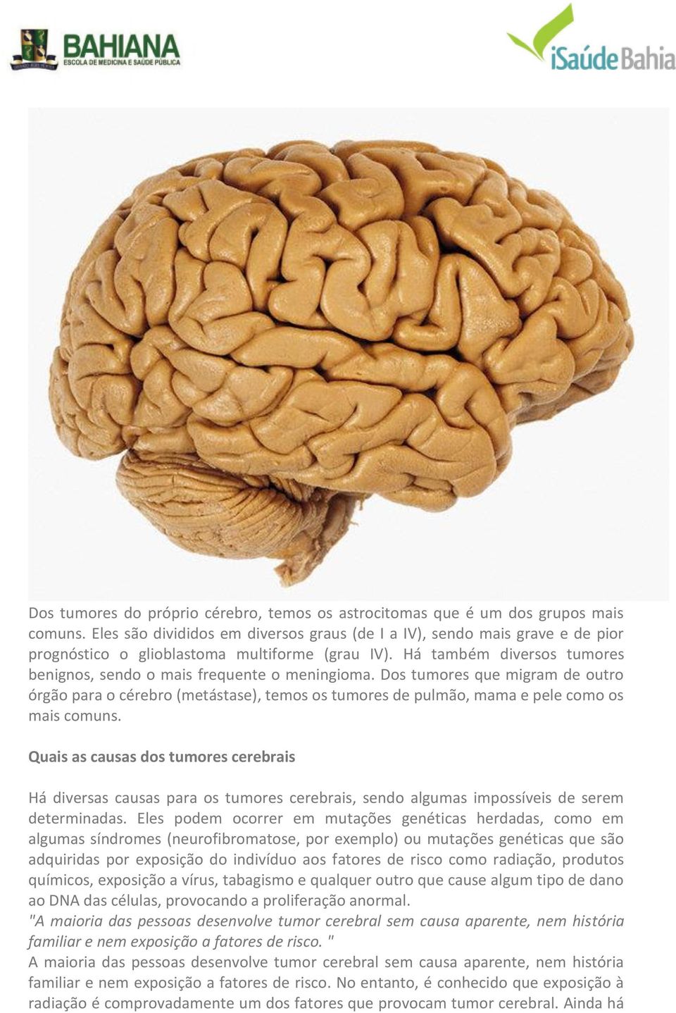 Dos tumores que migram de outro órgão para o cérebro (metástase), temos os tumores de pulmão, mama e pele como os mais comuns.